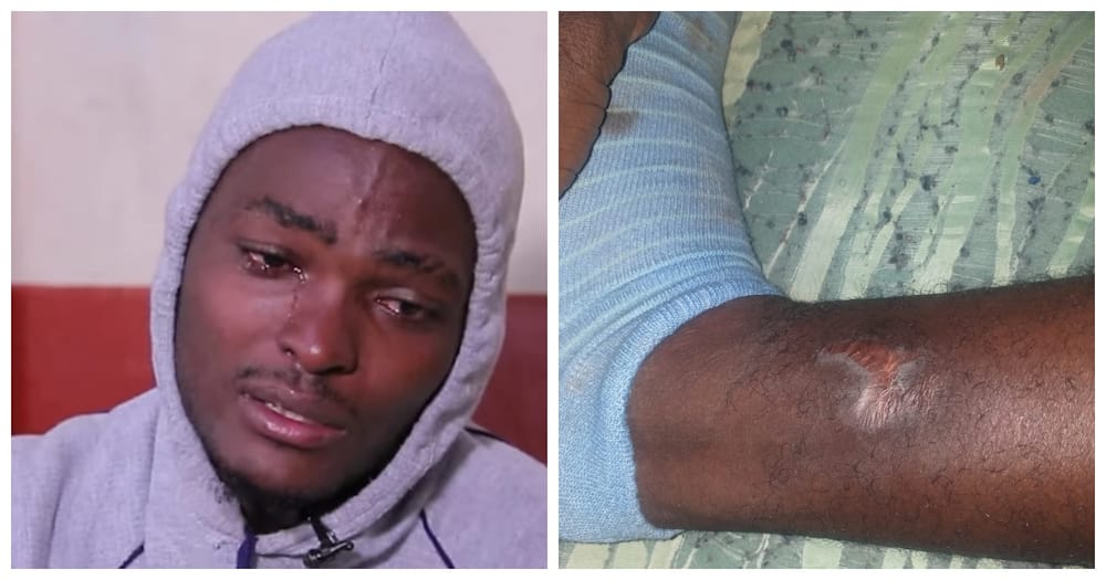 Rajab displays his scar on the leg where his wife injured him.