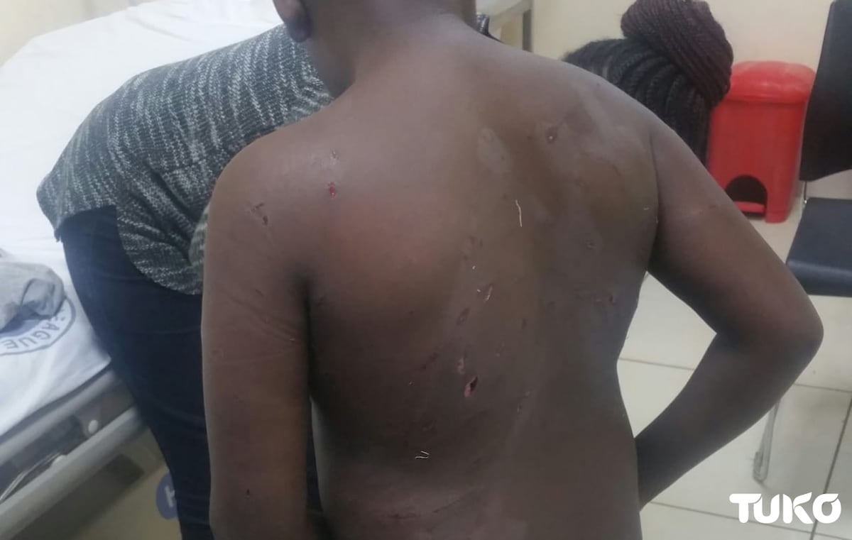 Son to assistant Director of Public Prosecution mauled by dogs while on school trip in Naivasha
