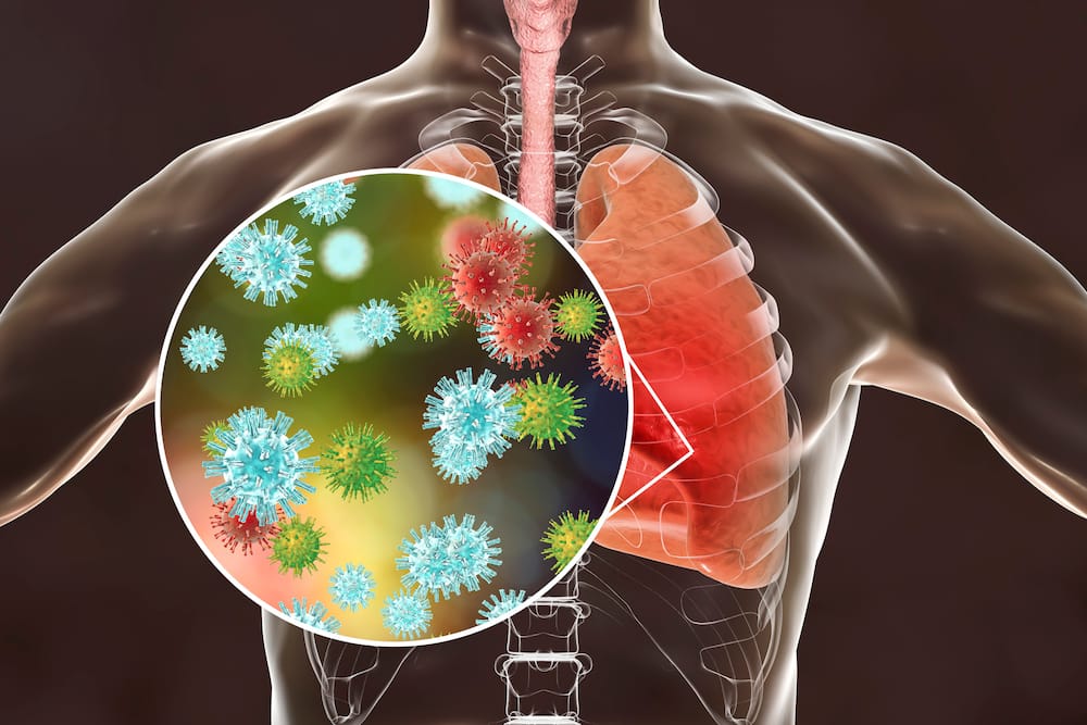 Maswali na majibu kuhusu coronavirus