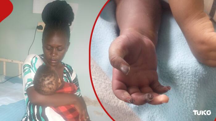 Kisumu Single Mum Whose Baby Was Wrongly Amputated Seeks KSh 132k to Clear Bill: "I'm All Alone"