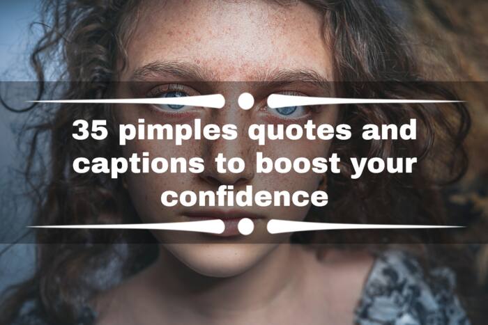 35 pimples quotes and captions to boost your confidence 
