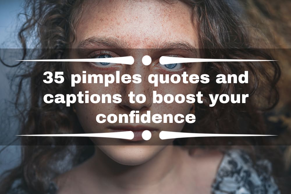 Pimples quotes