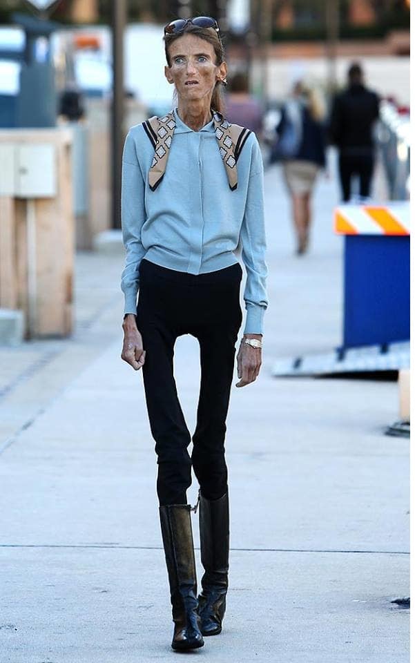 skinniest people ever