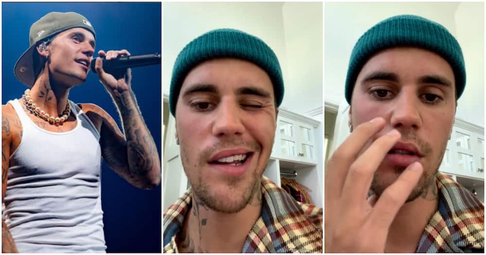 Justin Bieber Diagnosed With Ramsay Hunt Syndrome That Causes Partial Facial Paralysis, Hearing Loss