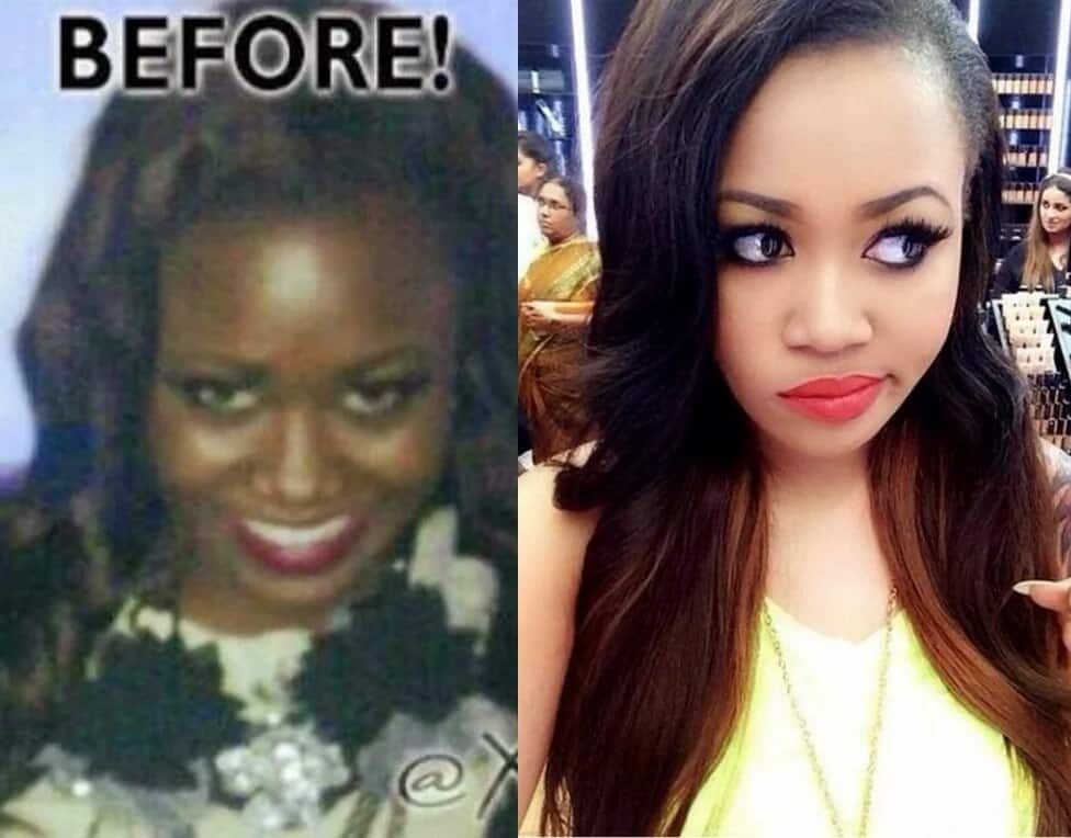Celebrities who bleached their skin