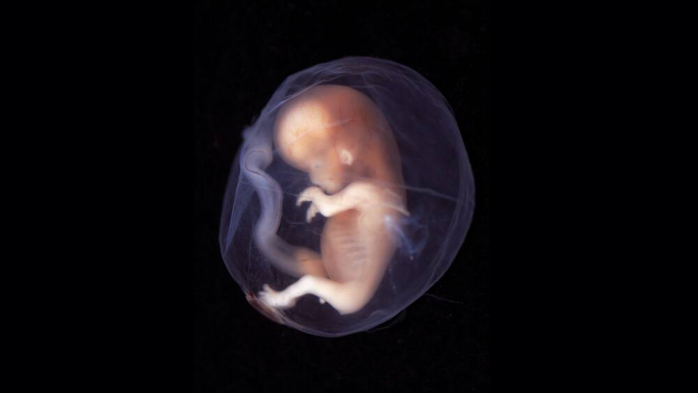 Malaysian man arrested with live human embryo in suitcase