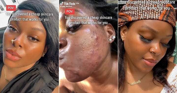 Lady's facial transformation stuns many