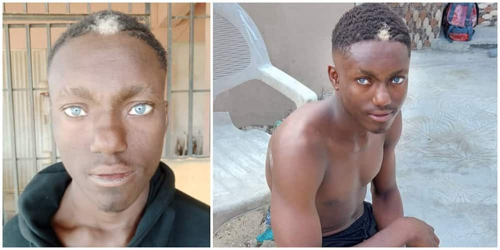 A Nigerian man with natural white hairs at the front of his head and light blue eyes has gone viral.