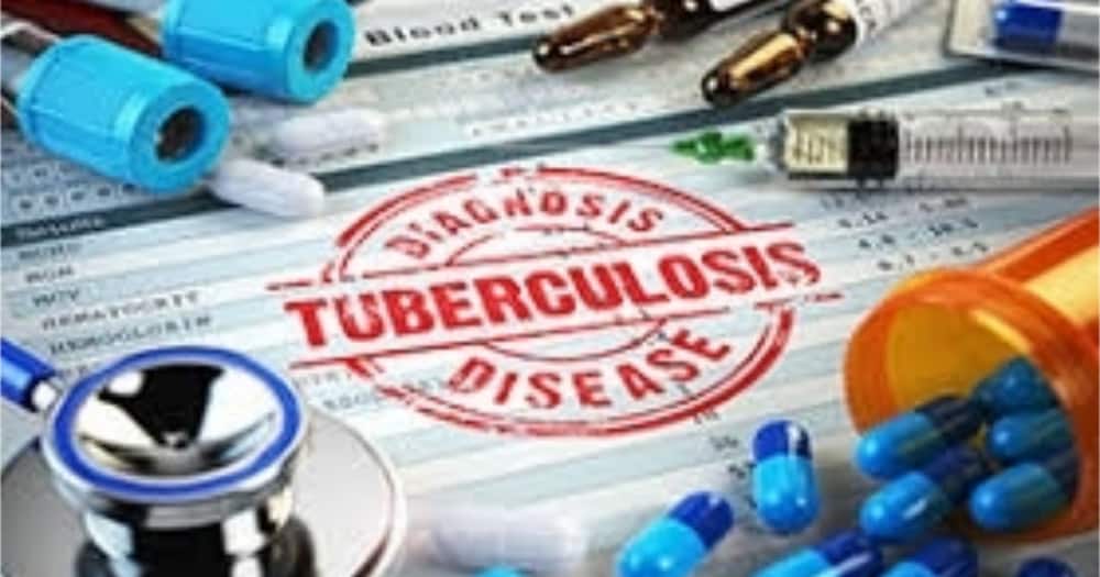 60 people die of TB in Kenya everyday state affirms