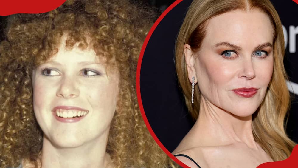 Nicole Kidman's face before the alleged face transformation (L). Her face after transformation (R)